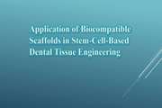 Application of Biocompatible Scaffolds in Stem-Cell-Based Dental Tissue Engineering