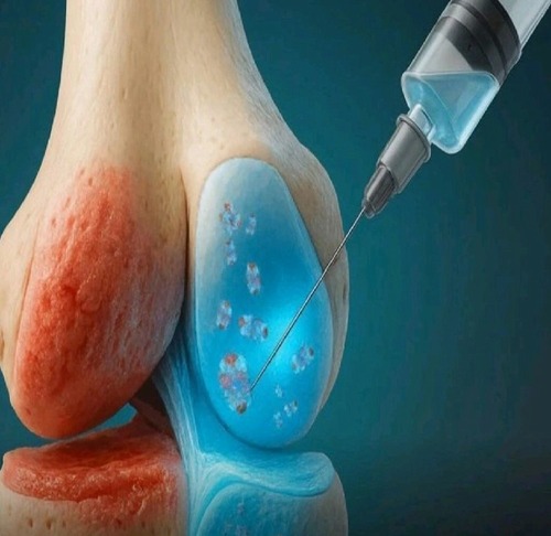 A new frontier opens in Regenerative Medicine on the care of damaged cartilage